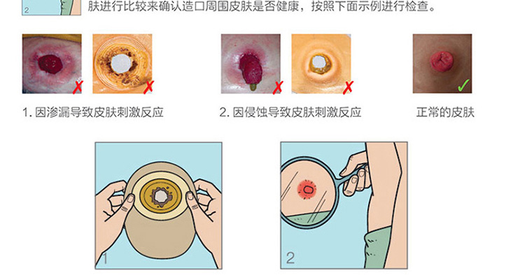 康乐保 造口护肤粉1907