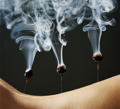 不用去医院自己在家治好各类妇科病